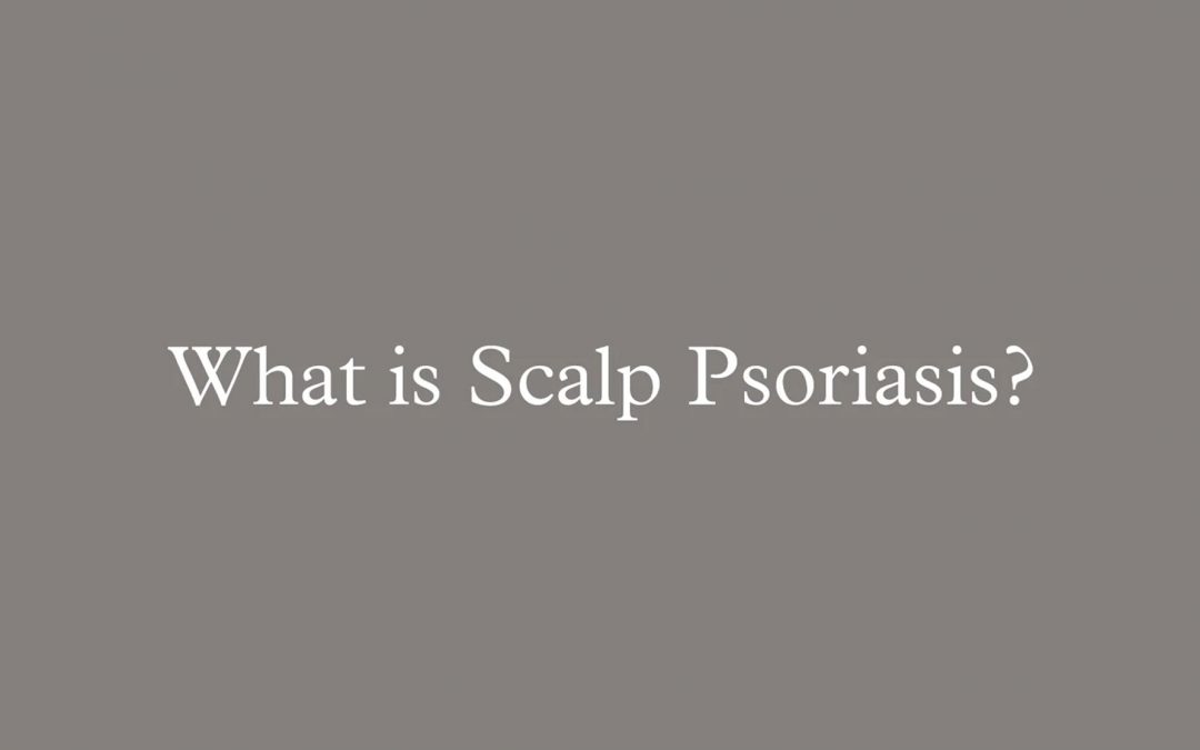 Blog Banner:What is Scalp Psoriasis?