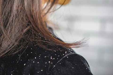 What is the difference between dry scalp and dandruff?